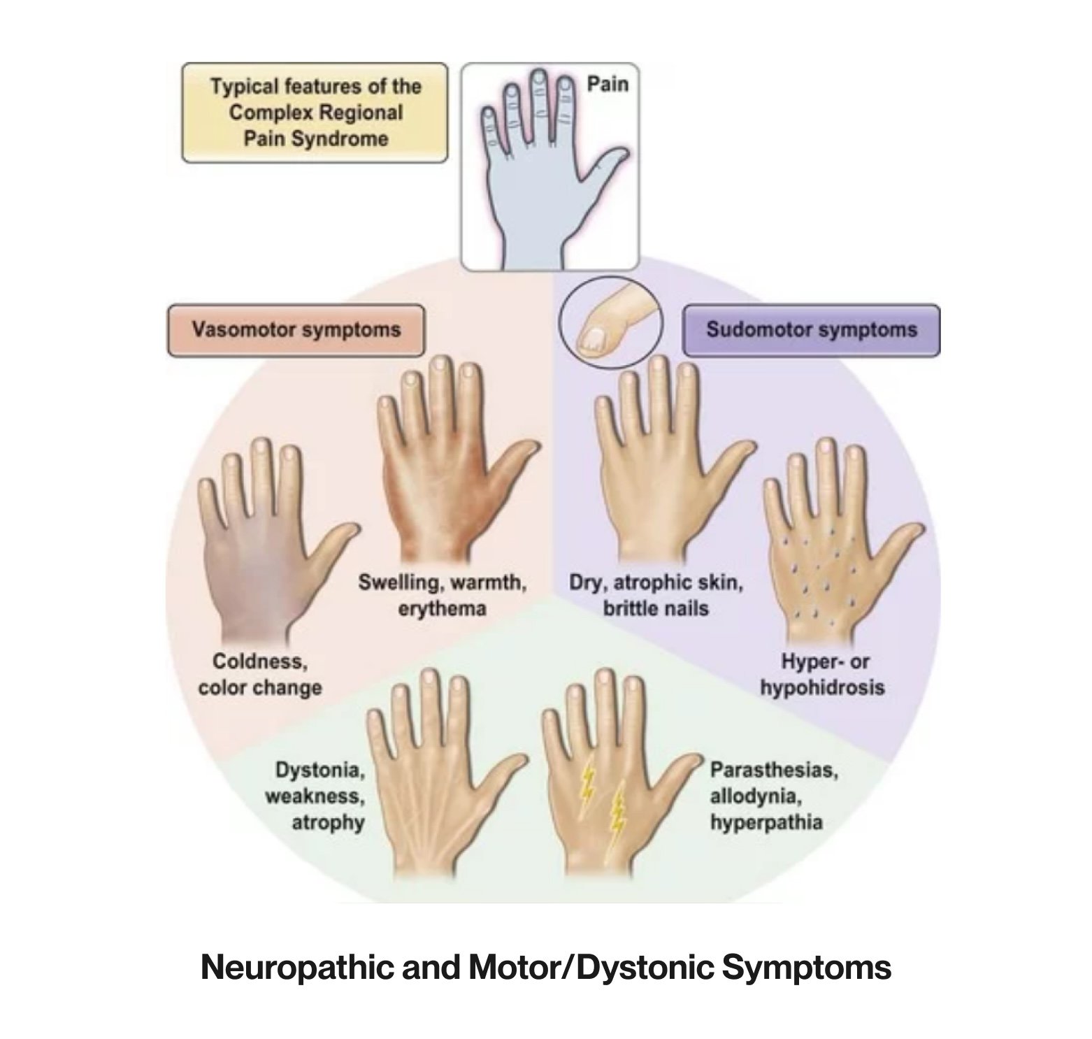 Revolutionizing Pain Management